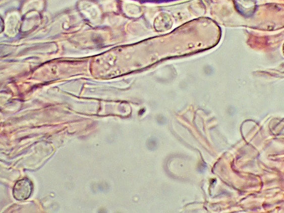 A proposito di Oxyporus.....(Oxyporus latemarginatus)