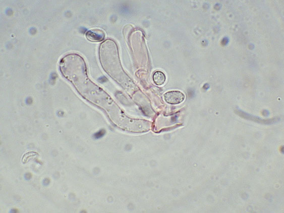 A proposito di Oxyporus.....(Oxyporus latemarginatus)
