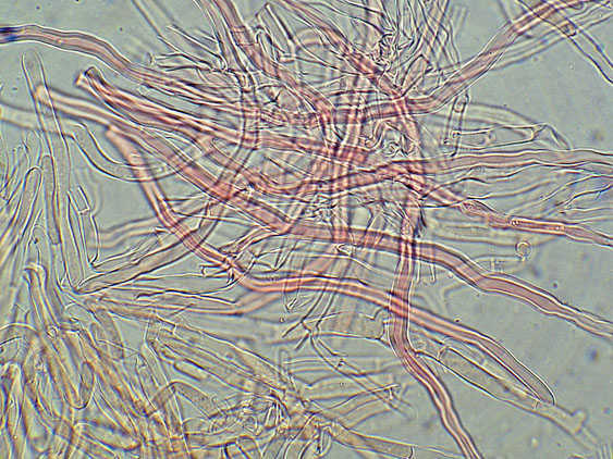 Phlebia nothofagi? (Irpex lacteus)