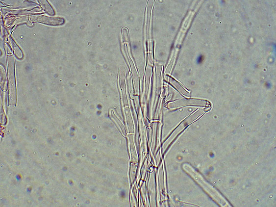 Phlebia nothofagi? (Irpex lacteus)