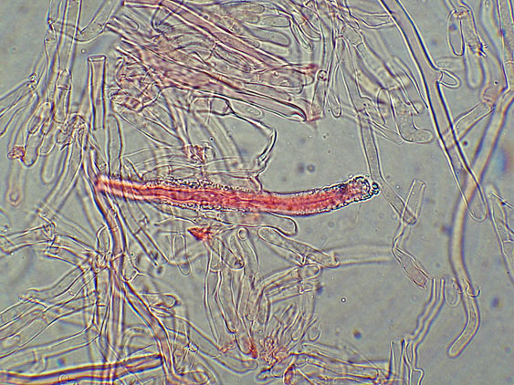 Phlebia nothofagi? (Irpex lacteus)