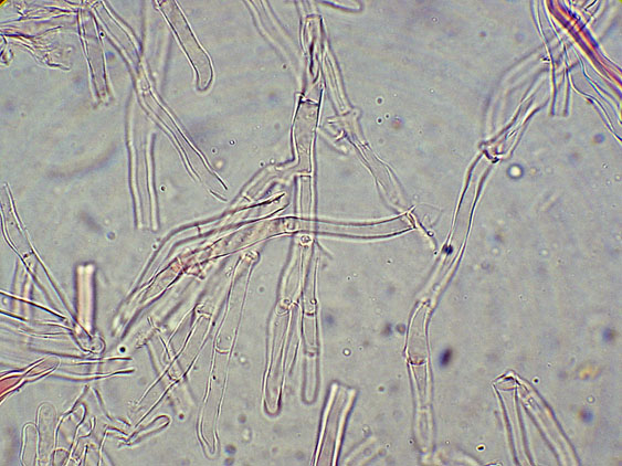 Phlebia nothofagi? (Irpex lacteus)