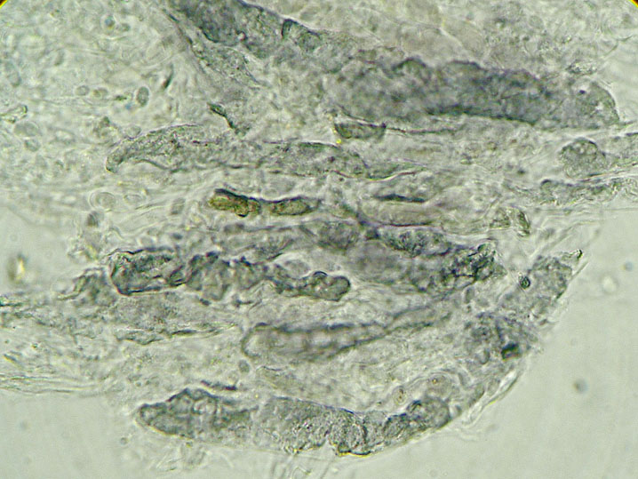 Peniophora aurantiaca (Bres.) Hhn. & Litsch.