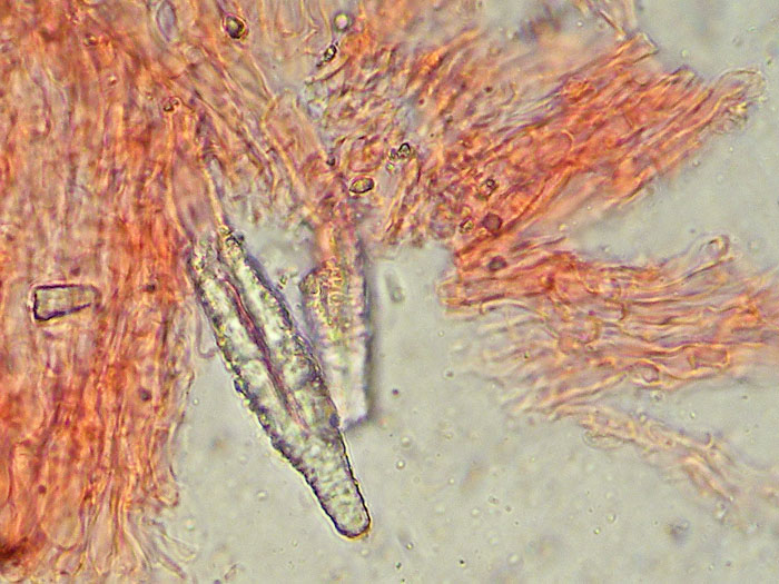Crosta gialla da deter. - foto 3951(Phlebiopsis ravenelii)