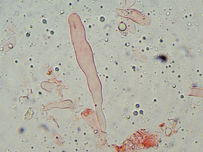 Plasmodio vs Phanerochaete?-foto3517(Hyphoderma roseocremeum