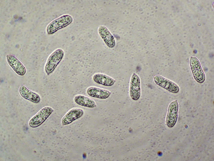 Plasmodio vs Phanerochaete?-foto3517(Hyphoderma roseocremeum