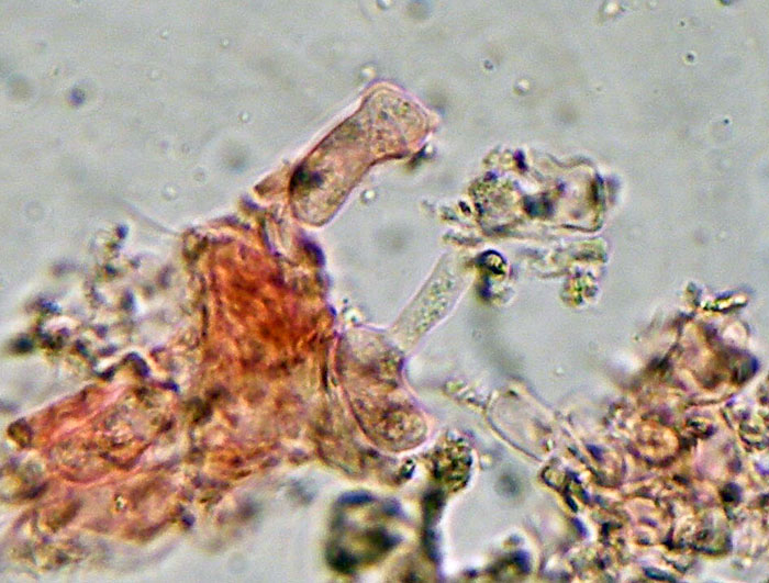 Exidiopsis effusa?
