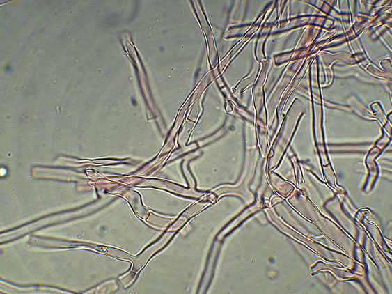 Phlebia nothofagi? (Irpex lacteus)