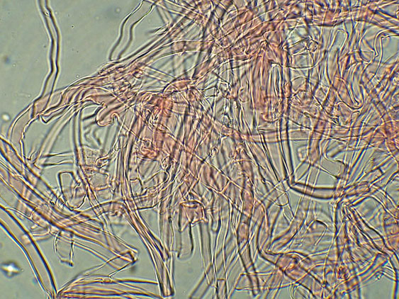 Phlebia nothofagi? (Irpex lacteus)
