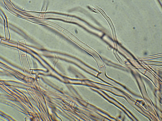 Phlebia nothofagi? (Irpex lacteus)