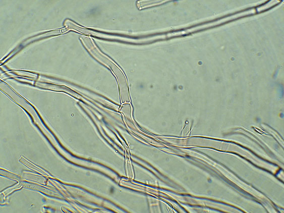 Phlebia nothofagi? (Irpex lacteus)