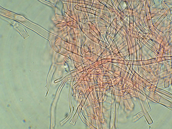 Phlebia nothofagi? (Irpex lacteus)