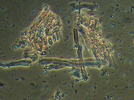 Forse Schizopora paradoxa? - foto 3343 (Phlebia aurea)