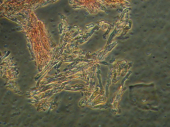 Forse Schizopora paradoxa? - foto 3343 (Phlebia aurea)