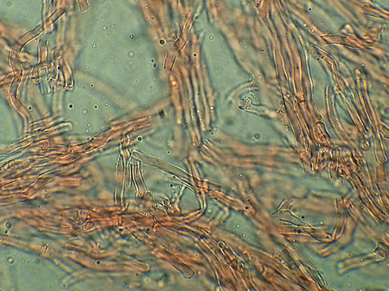 Forse Schizopora paradoxa? - foto 3343 (Phlebia aurea)