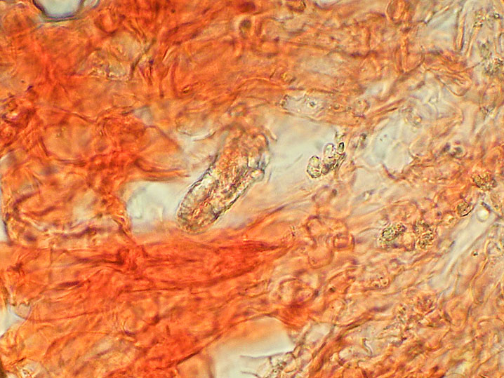 Peniophora aurantiaca (Bres.) Hhn. & Litsch.