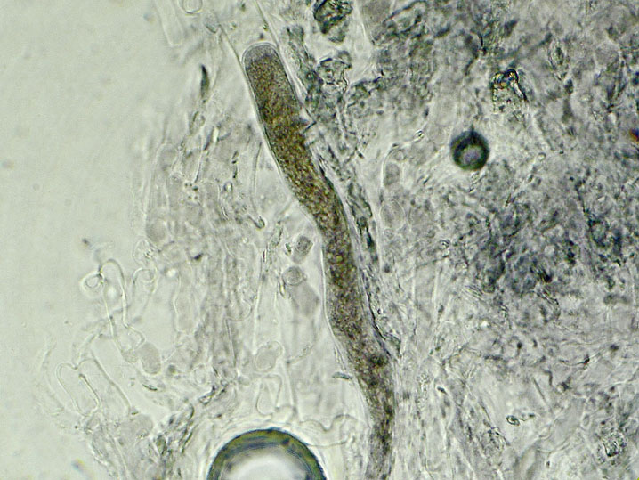 Peniophora aurantiaca (Bres.) Hhn. & Litsch.