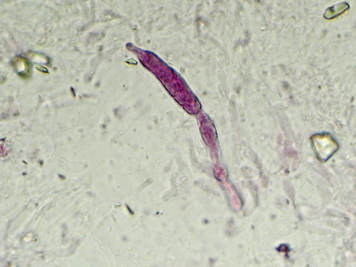 Gloeocystidiellum clavuligerum