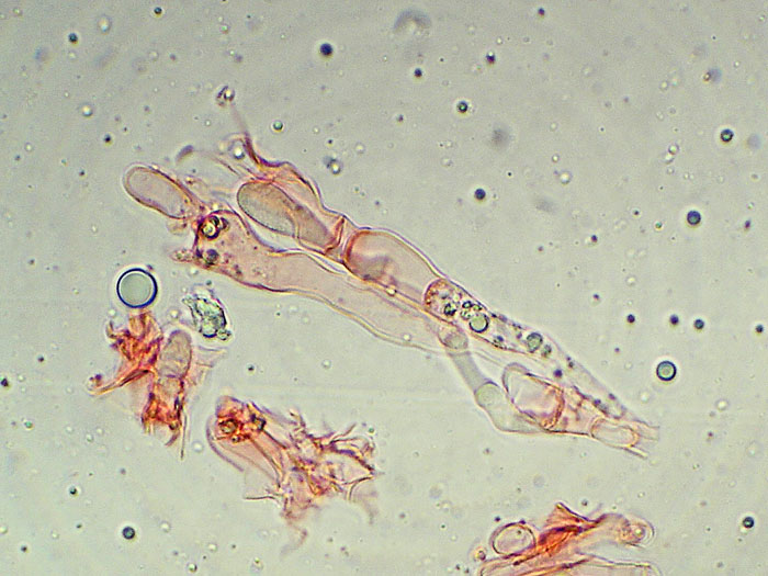 Plasmodio vs Phanerochaete?-foto3517(Hyphoderma roseocremeum