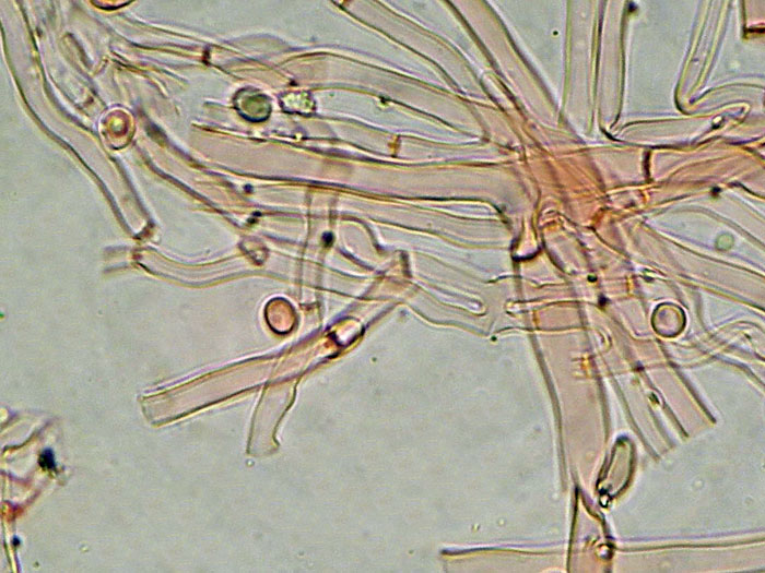 Una specie rara? (Byssoporia terrestris)