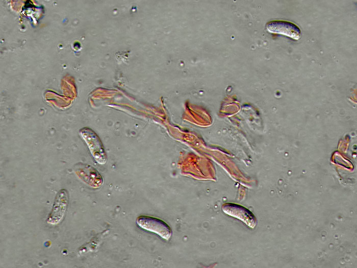 Forse un Hyphoderma con uncini?-foto 8606 (Peniophora laeta)