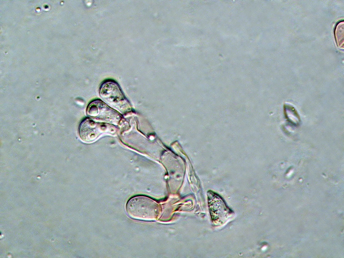 Tulasnella violacea