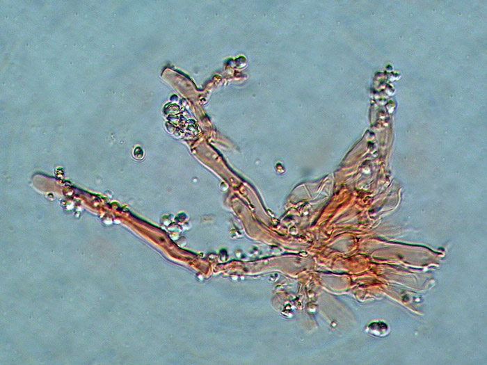 cfr. Mycoacia fuscoatra (Fr.) Donk (Schizopora paradoxa)