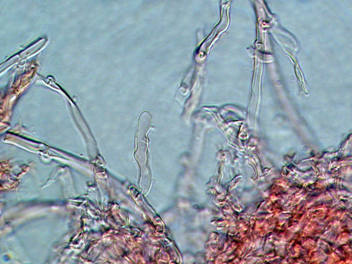 Raccolta N. 250412TC2233 (Mycoaciella bispora)