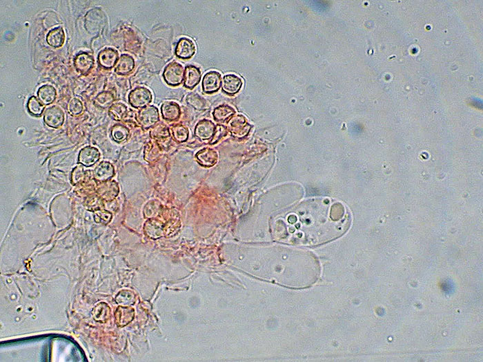 Tomentellopsis?
