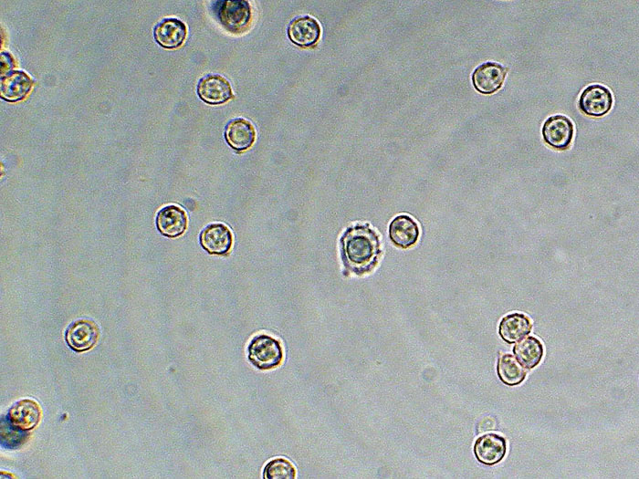 Tomentellopsis?