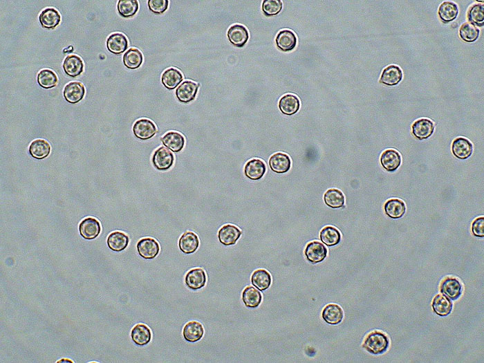 Tomentellopsis?