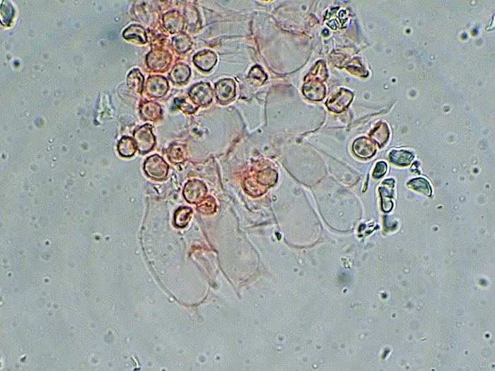 Tomentellopsis?