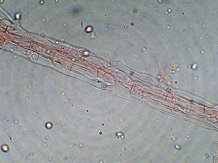 Tomentellopsis?