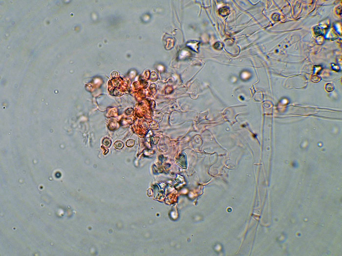 Tomentellopsis?