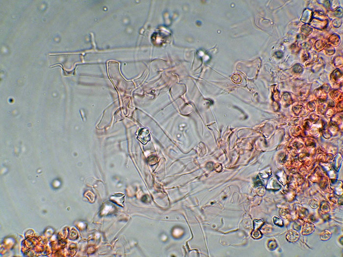 Tomentellopsis?