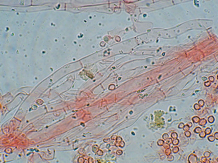 Tomentellopsis?