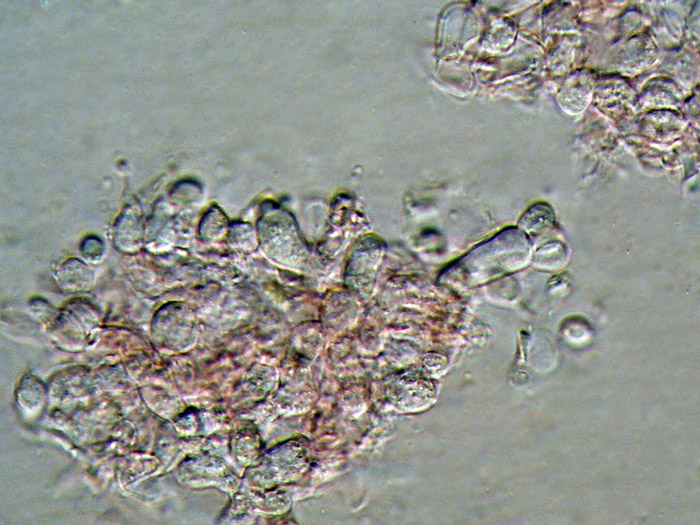 Tulasnella eichleriana ?