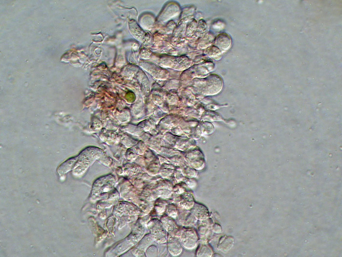 Tulasnella eichleriana ?