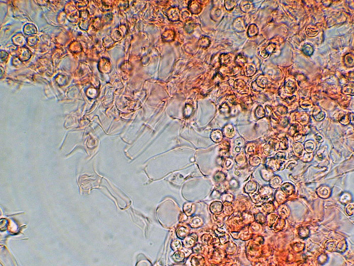 Tomentellopsis?