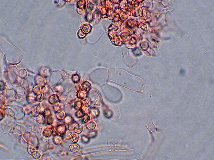 Tomentellopsis?
