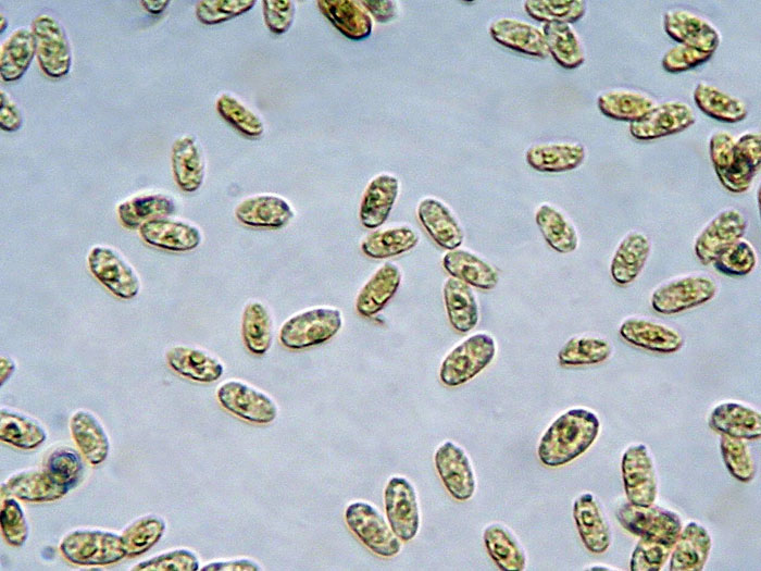 Raccolta N.260512TC1621 (Sistotremastrum suecicum)
