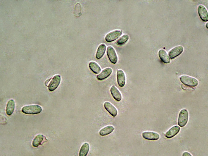 Raccolta N.260512TC1621 (Sistotremastrum suecicum)