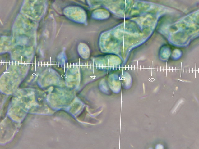 Botryobasidium con spore finemente verrucose