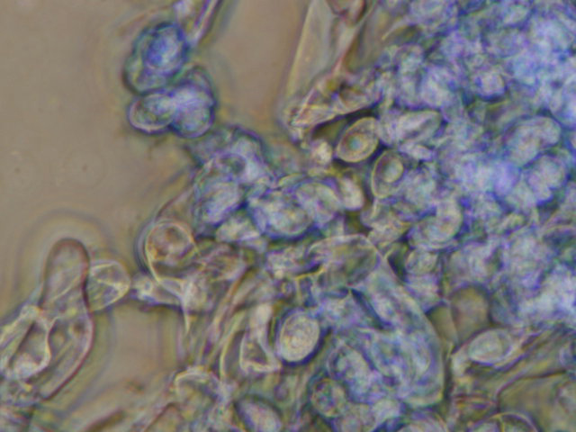 Botryobasidium con spore finemente verrucose