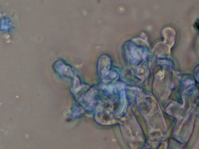 Botryobasidium con spore finemente verrucose