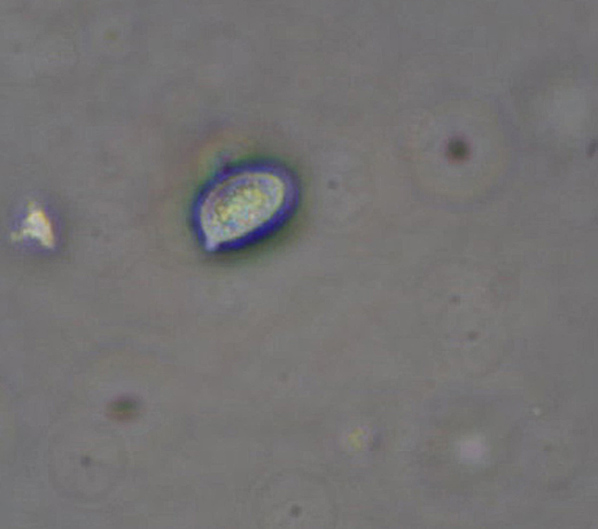 Botryobasidium con spore finemente verrucose