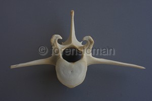 identificazione vertebre