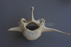 identificazione vertebre