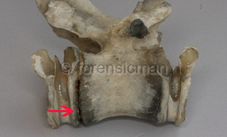 identificazione vertebre