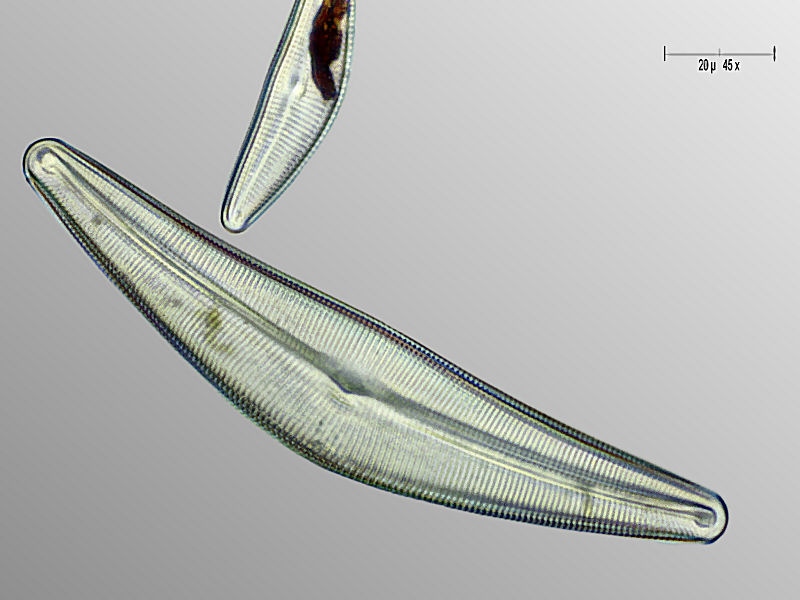 Cocconema gastroides, grande e piccola